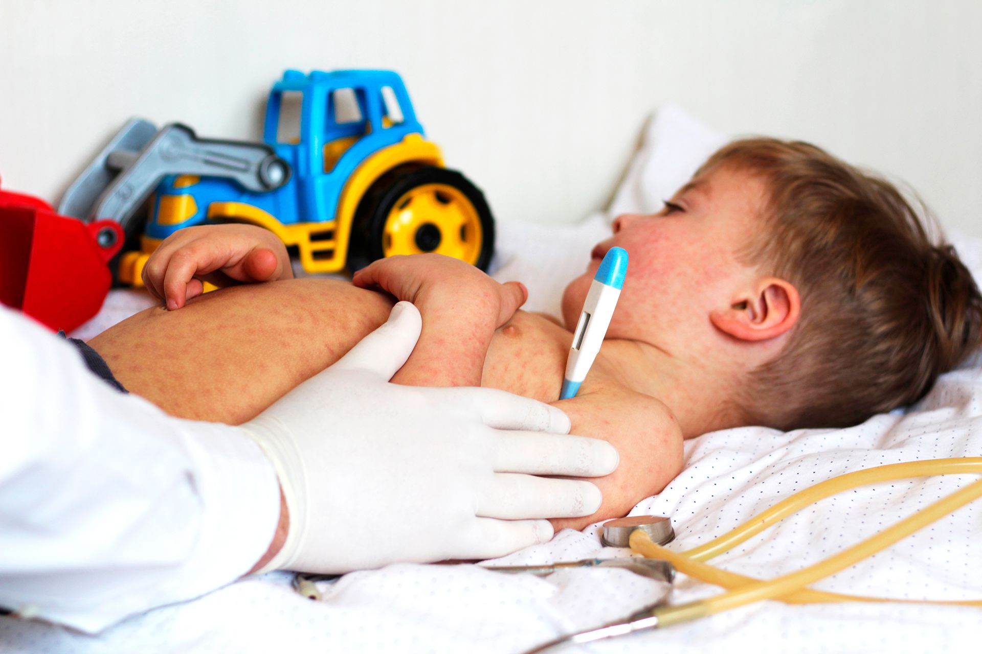 Los niños de 12 meses a cuatro años inclusive deben acreditar una dosis de vacuna triple viral (Shutterstock)