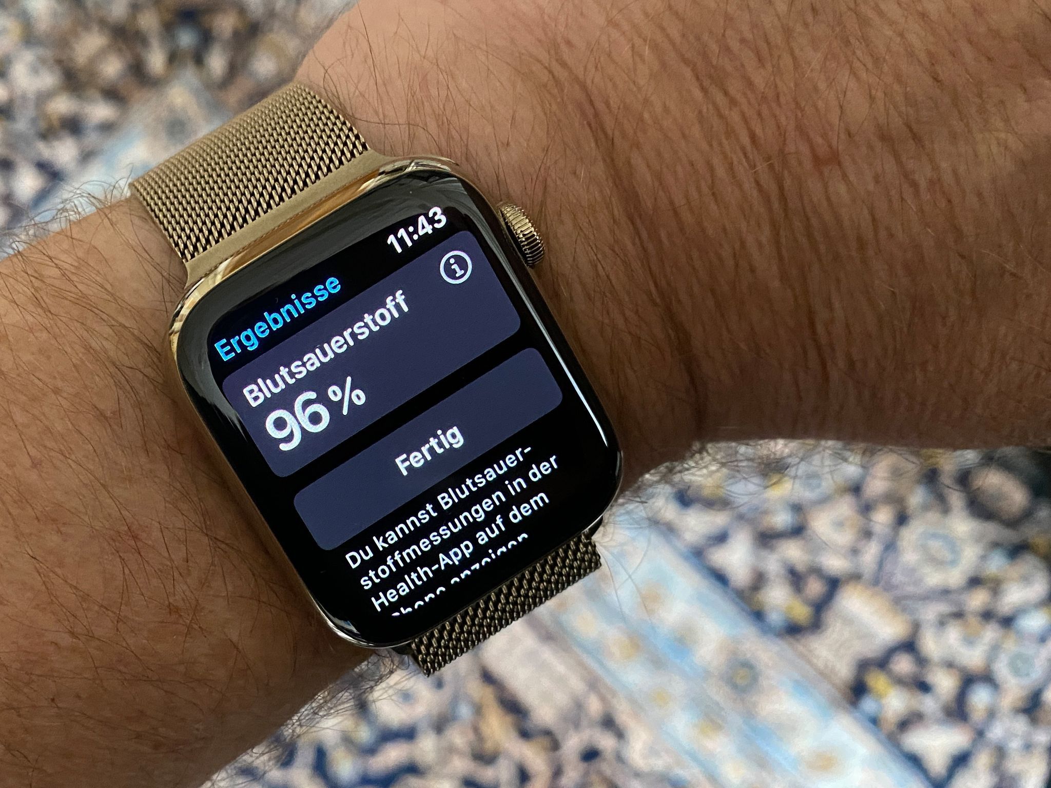 Zum Themendienst-Bericht von Christoph Dernbach vom 29. September 2020: Die Apple Watch Series 6 kann Puls und Blutsauerstoff messen und auch ein EKG erstellen.