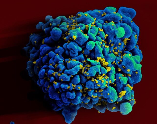 A 40 años de los primeros casos de VIH en el mundo, la historia de una epidemia que aún sigue vigente