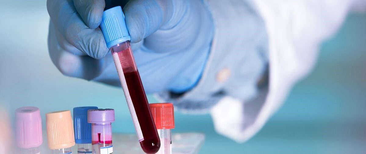 Un nuevo test de sangre permite la detección temprana de 50 tipos de cáncer