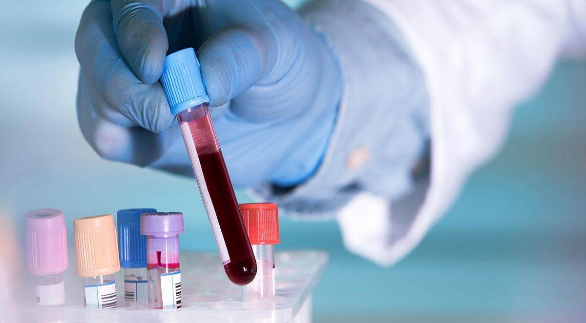 El test detecta los cambios químicos en fragmentos del ADN que se filtran a la sangre a través de los tumores 