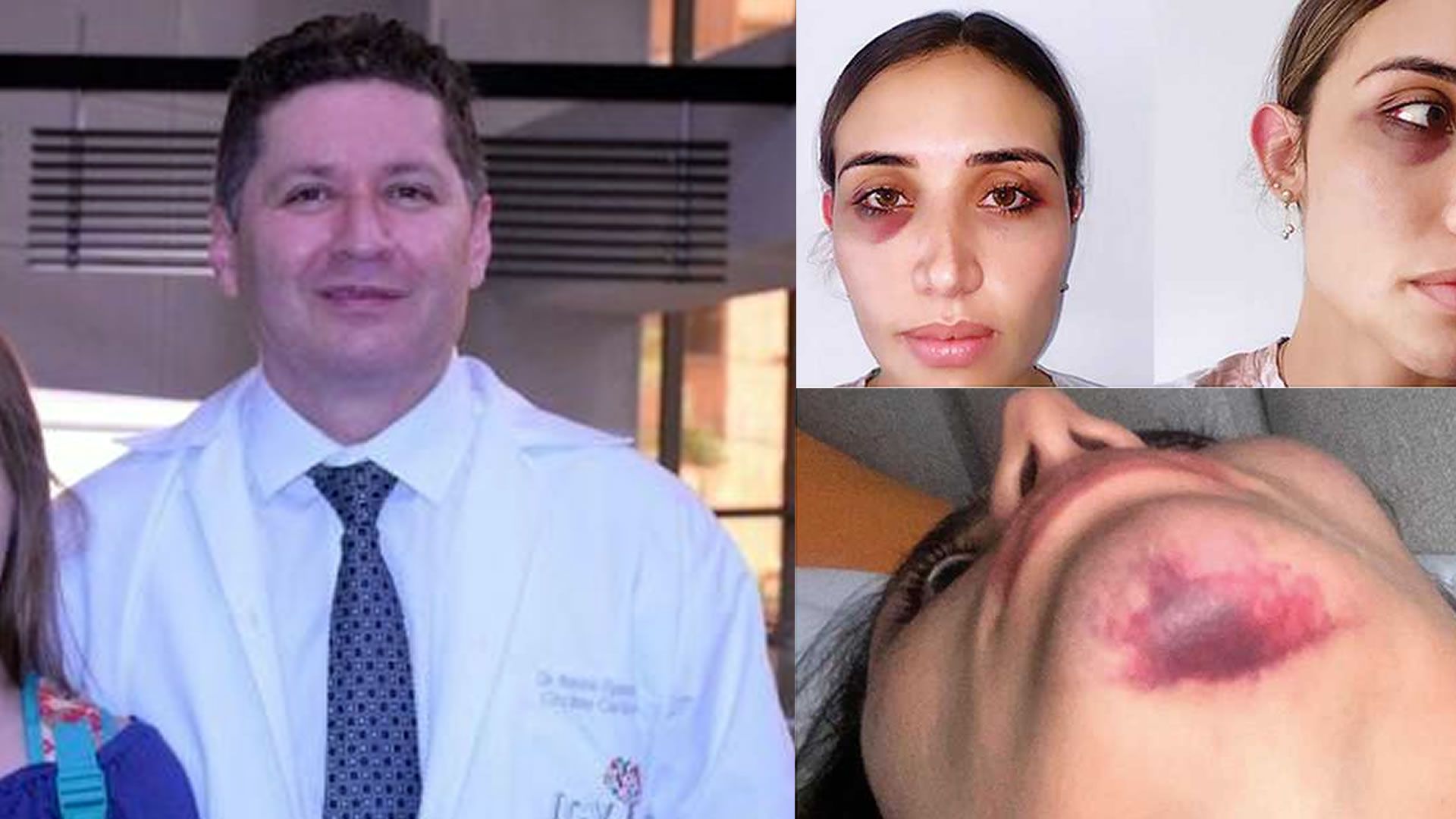 Otra médica suma su testimonio tras caso de agresión a mujer por el cardiólogo Antonio Figueredo.