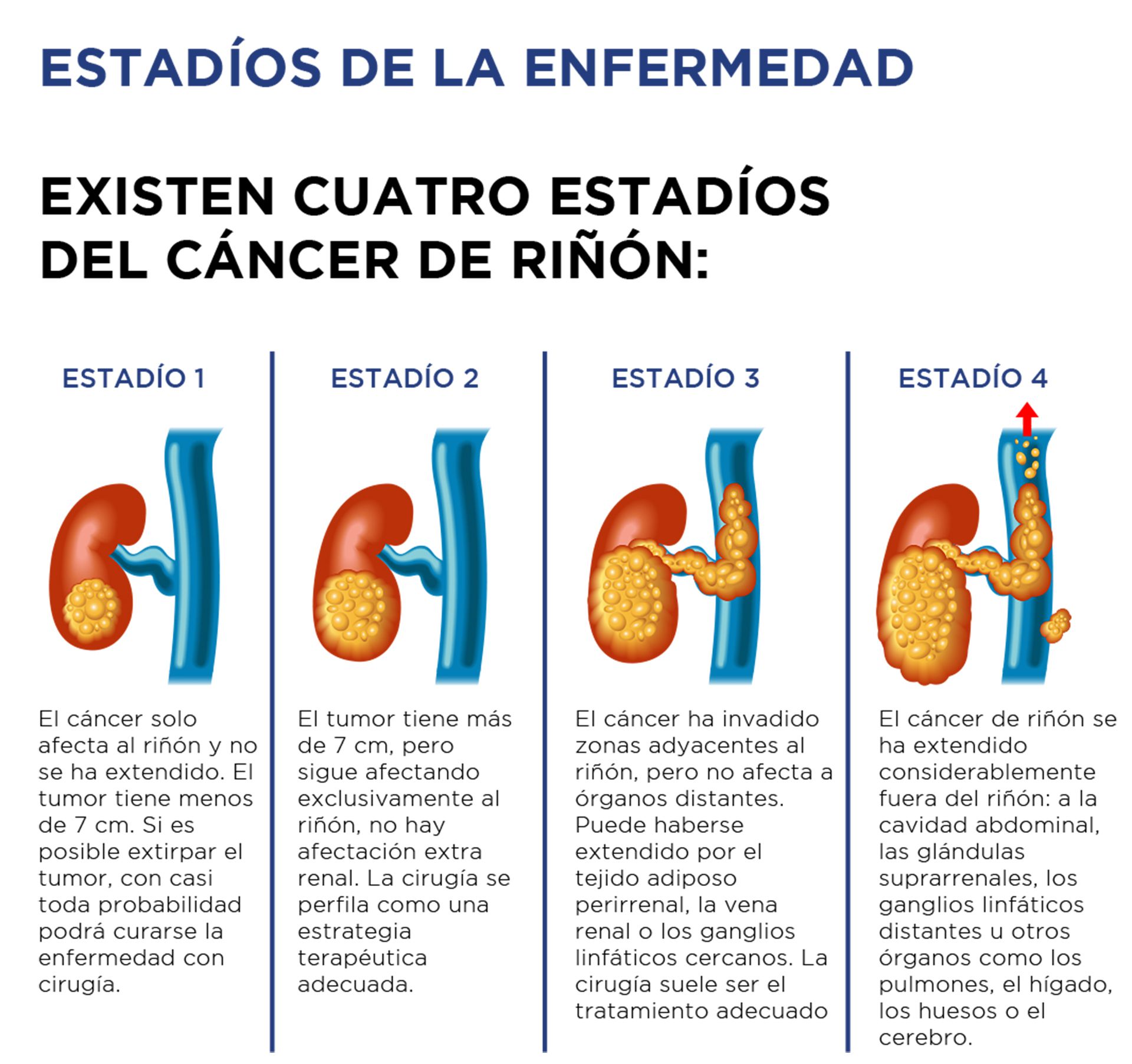 (Fuente: Bristol-Myers Squibb)