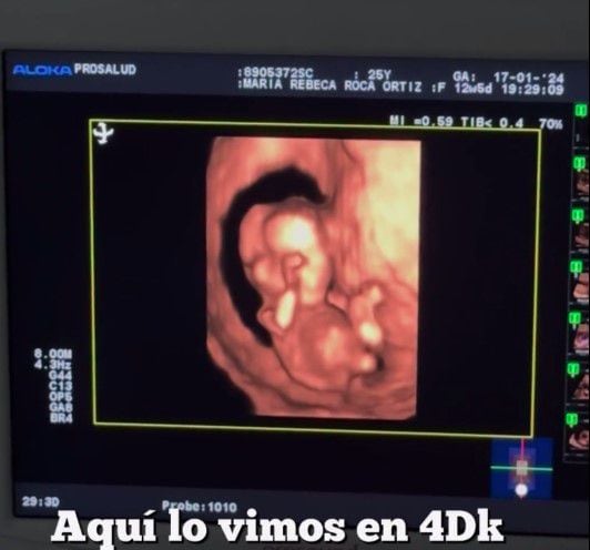 Giuseppe Benignini, expareja de Micheille Soifer tendrá a su primer hijo en Estados Unidos.