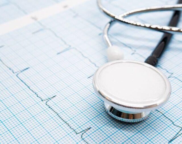 La inteligencia artificial podría impulsar la detección de la fibrilación auricular