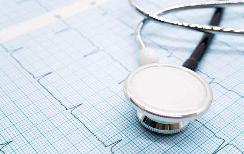 La inteligencia artificial podría impulsar la detección de la fibrilación auricular